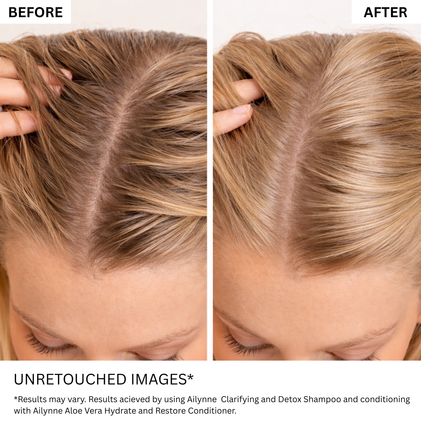 Clarifying & Detox Bundle